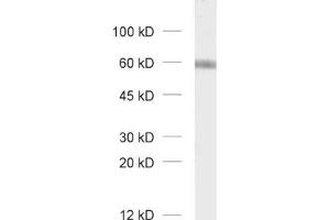 dilution: 1 : 1000, sample: unboiled synaptic membrane fraction of rat brain (LP1) (GABRA3 抗体  (AA 29-43))