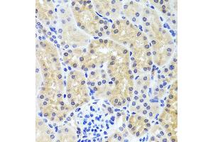 Immunohistochemistry of paraffin-embedded mouse kidney using INADL antibody at dilution of 1:100 (x40 lens). (PATJ 抗体)
