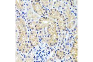 Immunohistochemistry of paraffin-embedded mouse kidney using INADL antibody at dilution of 1:100 (x40 lens). (PATJ 抗体)