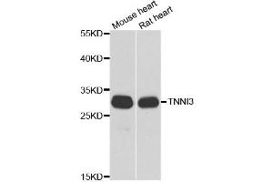 Western blot analysis of extracts of various cell lines, using TNNI3 antibody. (TNNI3 抗体)