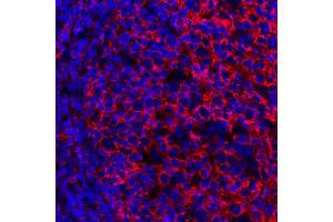 Immunofluorescence (IF) image for anti-Membrane-Spanning 4-Domains, Subfamily A, Member 1 (MS4A1) antibody (ABIN7449560)