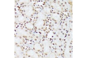 Immunohistochemistry of paraffin-embedded rat kidney using Phospho-c-Abl-Y412 antibody (ABIN7265966) at dilution of 1:100 (40x lens). (ABL1 抗体  (pTyr412))