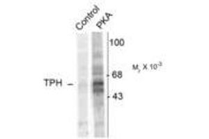 Image no. 1 for anti-Tryptophan Hydroxylase 1 (TPH1) (pSer58) antibody (ABIN227714) (Tryptophan Hydroxylase 1 抗体  (pSer58))
