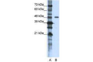 WB Suggested Anti-PPP1R8  Antibody Titration: 1. (PPP1R8 抗体  (N-Term))