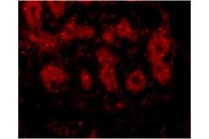 Image no. 1 for anti-Tripartite Motif Containing 5 (TRIM5) (C-Term) antibody (ABIN203830) (TRIM5 抗体  (C-Term))