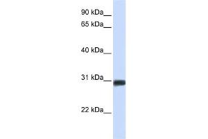 WB Suggested Anti-BARX2 Antibody Titration:  0.