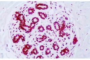 Image no. 3 for anti-Histone H3 (H3) (H3K18ac) antibody (ABIN2879163) (Histone 3 抗体  (H3K18ac))