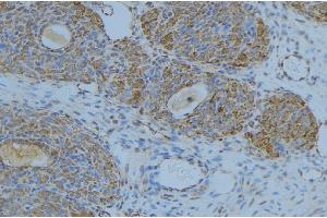 ABIN6276676 at 1/100 staining Human uterus tissue by IHC-P. (LIPC 抗体  (Internal Region))