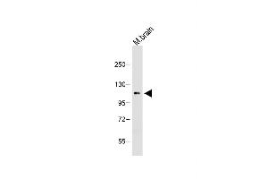 Anti-OTUD7A Antibody (N-term) at 1:1000 dilution + Mouse brain lysate Lysates/proteins at 20 μg per lane. (OTUD7A 抗体  (N-Term))