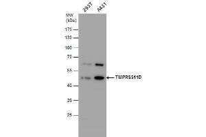 WB Image TMPRSS11D antibody detects TMPRSS11D protein by western blot analysis. (TMPRSS11D 抗体  (Center))