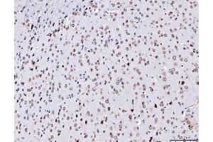 IHC analysis of TPR using anti-TPR antibody (ABIN7603243). (TPR 抗体  (N-Term))