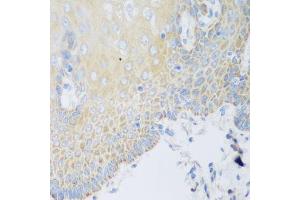 Immunohistochemistry of paraffin-embedded human esophagus using DHODH antibody. (DHODH 抗体  (AA 116-395))