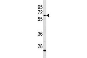 C8B antibody western blot analysis in CEM lysate (C8B 抗体  (AA 393-422))