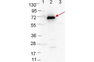 Western blot showing detection of 0. (OspC 抗体)