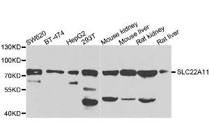 Western blot analysis of extracts of various cell lines, using SLC22A11 antibody. (SLC22A11 抗体  (AA 40-150))