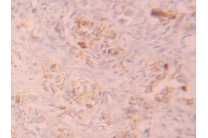 Detection of FGFR1 in Human Ovary Tissue using Polyclonal Antibody to Fibroblast Growth Factor Receptor 1 (FGFR1) (FGFR1 抗体  (AA 236-362))