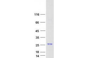 Western Blotting (WB) image for Actin Related Protein 2/3 Complex, Subunit 3, 21kDa (ARPC3) protein (Myc-DYKDDDDK Tag) (ABIN2714361)