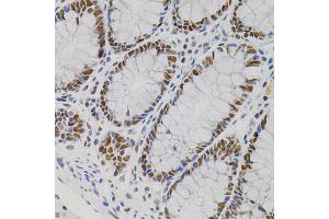 Immunohistochemistry of paraffin-embedded human colon using AKAP8 antibody (ABIN5975842) (40x lens). (AKAP8 抗体)