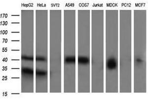 Image no. 4 for anti-Parvin, alpha (PARVA) antibody (ABIN1496446) (Parvin alpha 抗体)