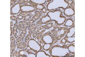 IHC analysis of Annexin A10/ANXA10 using anti-Annexin A10/ANXA10 antibody (ABIN7601853). (Annexin a10 抗体  (AA 49-324))