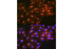 Immunofluorescence analysis of C6 cells using Cation-independent Cation-independent M6PR (IGF2R) (IGF2R) Rabbit mAb (ABIN1678848, ABIN3018066, ABIN3018067 and ABIN7101574) at dilution of 1:100 (40x lens). (IGF2R 抗体)