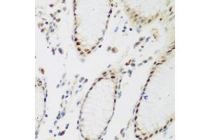 Immunohistochemistry of paraffin-embedded human gastric using PPAN antibody at dilution of 1:200 (40x lens). (PPAN 抗体)