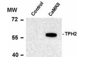 Image no. 1 for anti-Tryptophan Hydroxylase 1 (TPH1) (pSer19) antibody (ABIN303965) (Tryptophan Hydroxylase 1 抗体  (pSer19))