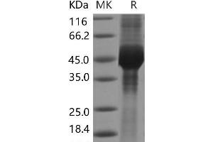 GDNF Family Receptor alpha 3 (GFRA3) protein (His tag)