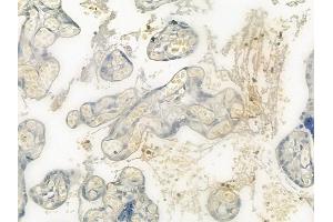 ABIN6265334 and ABIN6276392 at 1/100 staining human normal placenta tissue by IHC-P. (STEAP3 抗体  (N-Term))