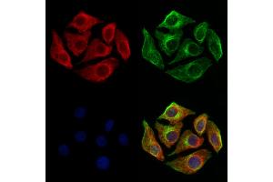 ABIN6260842 and ABIN6273209 staining Hela cells by IF/ICC. (SH3KBP1 抗体  (N-Term))