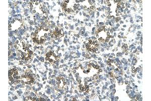 Rabbit Anti-SUV39H1 antibody   Paraffin Embedded Tissue: Human Lung cell Cellular Data: alveolar cell of renal tubule Antibody Concentration: 4. (SUV39H1 抗体  (N-Term))