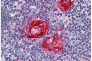 Immunohistochemistry (Formalin-fixed Paraffin-embedded Sections) (IHC (fp)) image for anti-Zinc Finger Protein 36, C3H Type, Homolog (Mouse) (ZFP36) (AA 41-90) antibody (ABIN768745)
