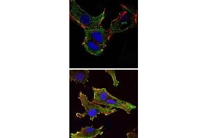 Immunofluorescence analysis of NTERA-2 cells (upper) and U251 (bottom) cells using KLHL13 monoclonal antibody, clone 8D1  (green) . (KLHL13 抗体)