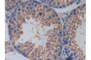 Immunohistochemistry (IHC) image for anti-Interleukin 17 Receptor A (IL17RA) (AA 590-848) antibody (ABIN7438775)