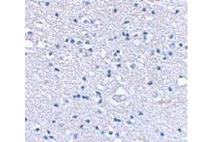 Immunohistochemical staining of human brain tissue using GRIK4 polyclonal antibody  at 2. (GRIK4 抗体  (N-Term))