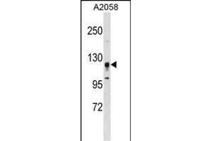 STK31 Antibody (F47) (ABIN391358 and ABIN2841378) western blot analysis in  cell line lysates (35 μg/lane).