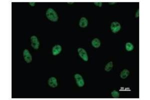 Immunostaining analysis in HeLa cells. (CDC5L 抗体)