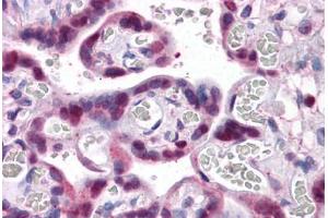 Human Placenta: Formalin-Fixed, Paraffin-Embedded (FFPE) (SMAD6 抗体  (AA 285-385))