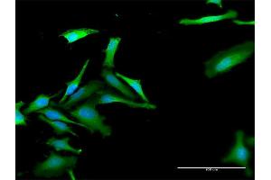 Immunofluorescence of purified MaxPab antibody to FBXO42 on HeLa cell. (FBXO42 抗体  (AA 1-716))