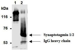 Western Blotting (WB) image for anti-Synaptotagmin I (SYT1) antibody (ABIN1109184) (SYT1 抗体)