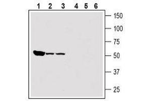 Western Blotting (WB) image for anti-ATPase, H+ Transporting, Lysosomal Accessory Protein 2 (ATP6AP2) (AA 200-214), (Extracellular) antibody (ABIN7042960)