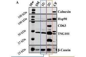 (A) Western Blot analysis of proteins present (Hsp90, CD63 and TSG101) or absent (calnexin) in exosomes and abundant in bovine milk (β-casein). (CD63 抗体  (AA 101-200))