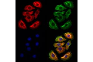 ABIN6262304 and ABIN6272944 staining Hela cells by IF/ICC. (HMGCS1 抗体  (Internal Region))