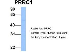 Host: Rabbit  Target Name: PRRC1  Sample Tissue: Human Fetal Lung  Antibody Dilution: 1. (PRRC1 抗体  (Middle Region))