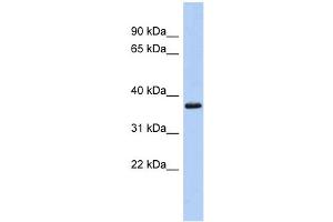 WB Suggested Anti-MBP Antibody Titration: 0. (MBP 抗体  (Middle Region))