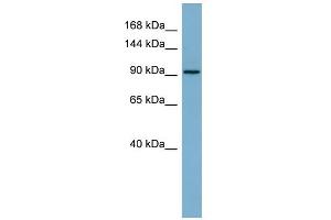 WB Suggested Anti-RAI14 Antibody Titration: 0. (RAI14 抗体  (Middle Region))