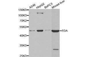 Western blot analysis of extracts of various cell lines, using EDA antibody. (Ectodysplasin A 抗体)