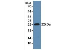 Detection of Recombinant ADM, Mouse using Polyclonal Antibody to Adrenomedullin (ADM) (Adrenomedullin 抗体  (AA 24-171))