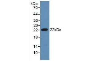 Detection of Recombinant ADM, Mouse using Polyclonal Antibody to Adrenomedullin (ADM) (Adrenomedullin 抗体  (AA 24-171))