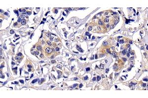 Immunohistochemistry (IHC) image for anti-V-Akt Murine Thymoma Viral Oncogene Homolog 1 (AKT1) (AA 122-443) antibody (ABIN7439390)